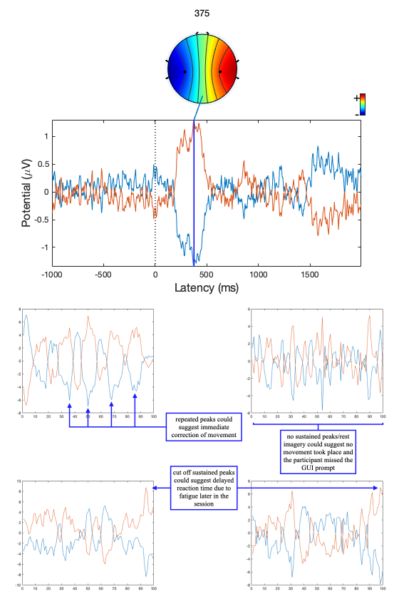 Figure 17: Examples of incorrectly classified samples compared to ERP of ideal motor imagery.