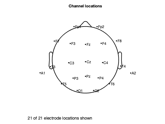 Figure 7: Locations of electrodes in [18], according to the 10-20 International System [13].