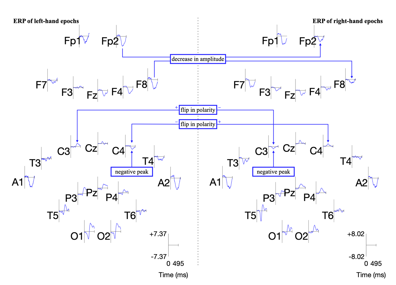 Figure 8: ERP of each electrode for L/R imagery